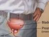 5 Early Signs of Prostate Enlargement Every Man Should Be Aware Of