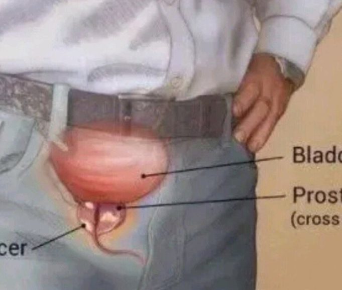5 Early Signs of Prostate Enlargement Every Man Should Be Aware Of