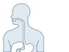 Colon Cancer Kills: If You Notice These Signs, Kindly Rush to the Hospital for a Check-Up