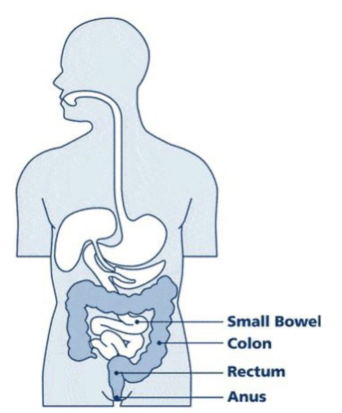 Colon Cancer Kills: If You Notice These Signs, Kindly Rush to the Hospital for a Check-Up