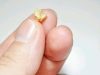 If These Objects Come Out From Your Mouth After Coughing, This Is What It Means
