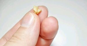 If These Objects Come Out From Your Mouth After Coughing, This Is What It Means