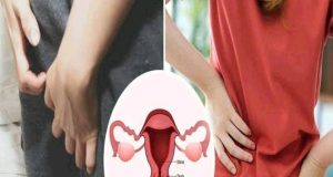 Vaginal Cancer: The Early Symptoms Females Should Not Ignore