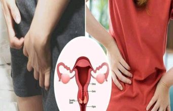 Vaginal Cancer: The Early Symptoms Females Should Not Ignore