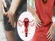 Vaginal Cancer: The Early Symptoms Females Should Not Ignore