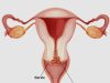 Cervical Cancer: The Silent Disease Every Woman Should Be Aware Of.