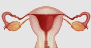 Cervical Cancer: The Silent Disease Every Woman Should Be Aware Of.