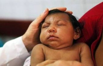 Reasons why some pregnant women give birth to disabled babies