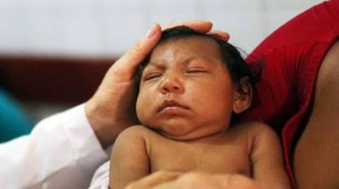 Reasons why some pregnant women give birth to disabled babies