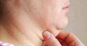 Simple Ways to Help Prevent Sagging Skin Around the Neck Area