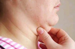 Simple Ways to Help Prevent Sagging Skin Around the Neck Area