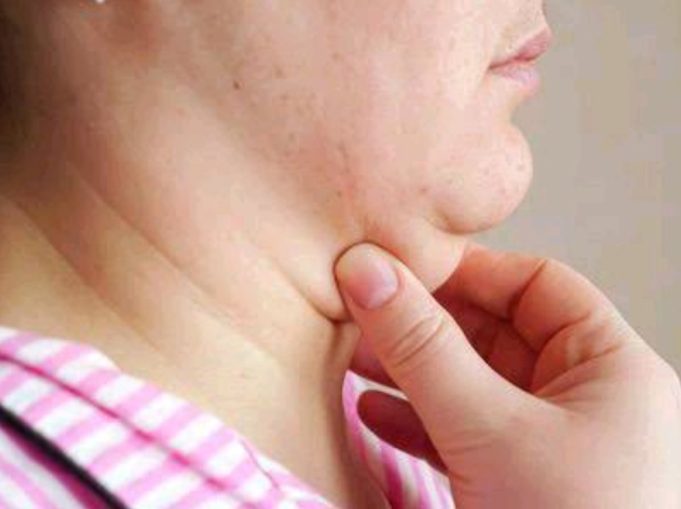 Simple Ways to Help Prevent Sagging Skin Around the Neck Area