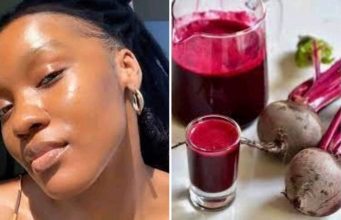 Dear Ladies, If You Want To Have A Natural, Glowing Skin, Start Eating These 5 Foods