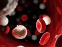Blood cancer kills. Please avoid taking these things in excess