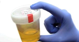 Warning Signs in Your Urine That Could Signal Kidney Trouble