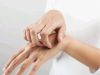 Itchy Palms Does Not Call For Money; Here Is What It Means About Your Health