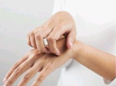 Itchy Palms Does Not Call For Money; Here Is What It Means About Your Health