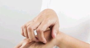 Itchy Palms Does Not Call For Money; Here Is What It Means About Your Health