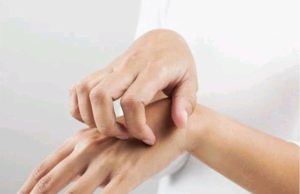 Itchy Palms Does Not Call For Money; Here Is What It Means About Your Health