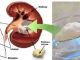 Repair Kidney Damage Quickly with Just One Teaspoon of a Common Household Ingredient