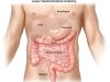 Colon Cancer Kills: If You Notice These Signs, Rush to the Hospital for Check Up